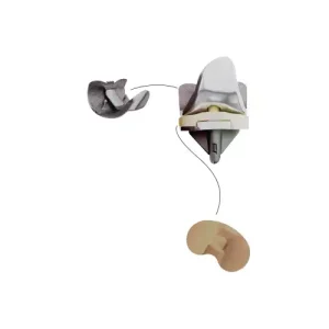 BIO Cementless Total Knee System