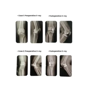 Excellent Case sharing